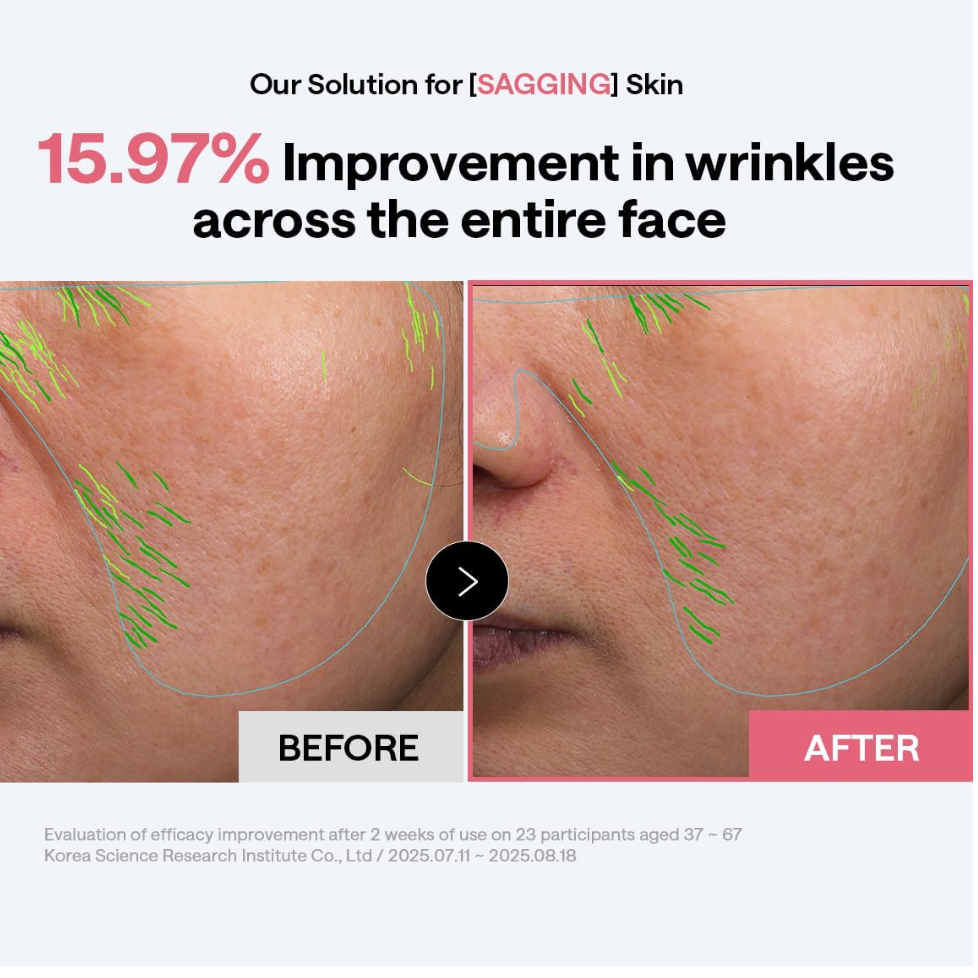 (Lift & Firm)- Collagen Ampoule Pad
