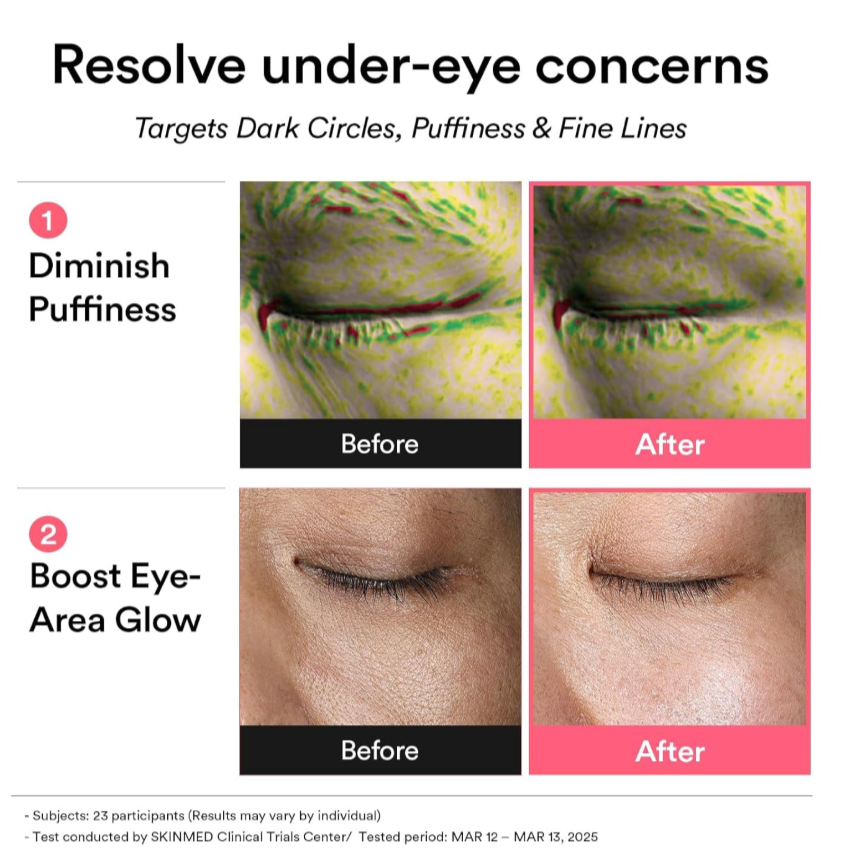(Lift & Firm)-ABIB PDRN Retinal Eye Patch Glow Jelly
